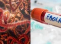 Congo Ebola outbreak 2026